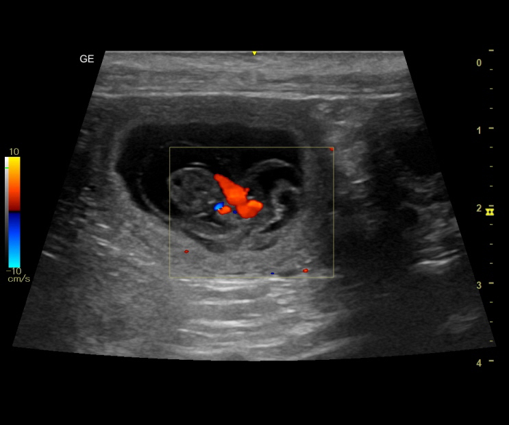 Ultraschall210323